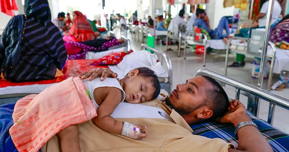 হামে আক্রান্ত শিশুদের ৬৫% অপুষ্টির শিকার