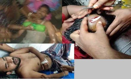 তাড়াশে প্রতিপক্ষের হামলায় ছাত্রলীগের সম্পাদকসহ আহত ৮, আটক ৩