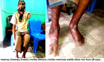 সকলের সহযোগীতায় রাজমিস্ত্রি ফরিদ বাঁচতে চায়!