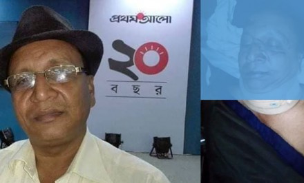 সাংবাদিক এনামুল হক খোকন সড়ক দূর্ঘটনায় গুরুতর আহত