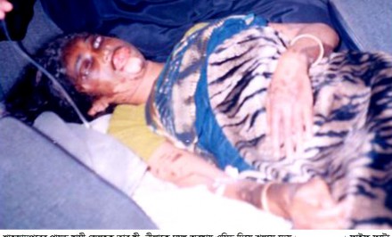 বাংলাদেশে এসিড সন্ত্রাসের ঘটনায় শাহজাদপুরসহ সিরাজগঞ্জ শীর্ষে!
