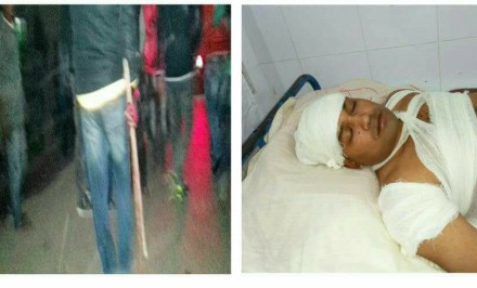 উল্লাপাড়ায় সাংবাদিক শিশির সন্ত্রাসী হামলায় গুরুতর আহত; শাহজাদপুরের সাংবাদিকদের তীব্র নিন্দা ও ক্ষোভ