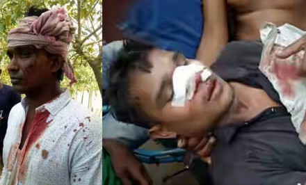 শাহজাদপুরে দু‘দল গ্রামবাসির মধ্যে রক্তক্ষয়ী হামলা সংঘর্ষঃ পৌর কাউন্সিলর সহ ১৫ জন আহত