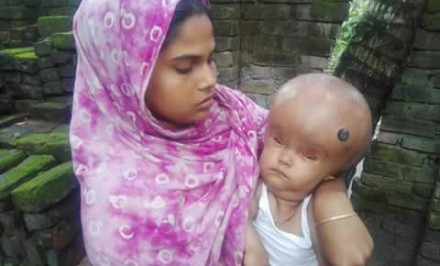 মৃত্যু পথযাত্রী দুধের শিশু আলিফকে বাঁচাতে এগিয়ে আসুন