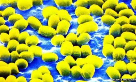 শাহজাদপুরে অ্যানথ্রাক্স আক্রান্ত আরো ৯ জন সনাক্ত