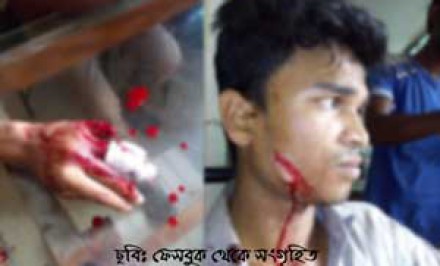 শাহজাদপুরে যুবলীগের দুই গ্রুপের রক্তক্ষয়ী হামলা সংঘর্ষঃ শিশুসহ ১২ জন আহত