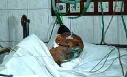 ভাষা মতিনের মস্তিস্কে সফল অস্ত্রোপচার